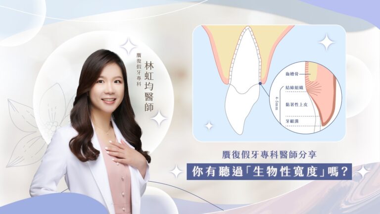 生物性寬度是牙周組織中一個重要的概念，指的是牙齦溝底部到齒槽骨之間必須保持一定距離的軟組織附著，以保證維持牙齒與周圍組織的健康。而一般來說，需要距離約2mm，才不會造成侵犯到生物性寬度的狀況呦！