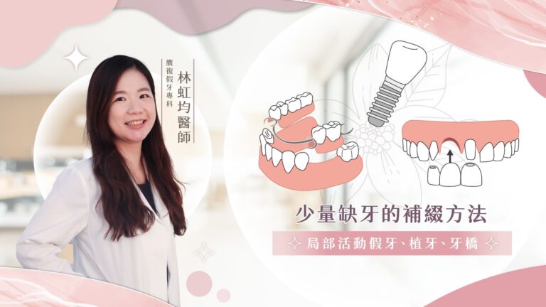 我們之前一直聊到「全口重建」、「大面積缺牙」的補綴方法，但是......如果是少量缺牙，應該要怎麼做才好呢？總不能把牙齒全部拔光光，或是只有植牙一個選項吧？今天，就讓贋復假牙專科林虹均牙醫師和大家分享：少量補牙的補綴方法有哪些？分別適合哪些人。