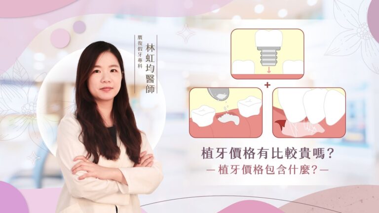 在面臨局部缺牙時，很多人會比較不同的補缺牙方案，會在活動假牙、牙橋又或者是植牙之間猶豫、掙扎著做選擇，不過......在璽瑞，我遇到了很多患者都會跟我們說「覺得植牙比較貴」、「覺得植牙的價格好不透明、不確定裡面包含哪些項目」，今天，就特地來跟大家分享：植牙價格有比較貴嗎？植牙價格包含什麼？