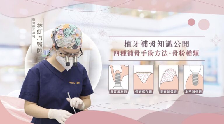 仔細想想，缺牙既影響咀嚼又影響外貌，真的好令人苦腦。 而植牙是一種能恢復功能與美觀的有效解決方案，但成功的關鍵在於齒槽骨的穩固程度。就像建造房子需要堅實的地基，齒槽骨不足時，無論植體再先進，仍可能因支撐不足而失敗。因此，在植牙之前，進行齒槽骨的評估及必要的補骨治療，是確保植牙穩定性與長期成功的關鍵。齒槽骨就像建築物的基石，提供穩固的支撐，同時為植體的骨整合奠定基礎。