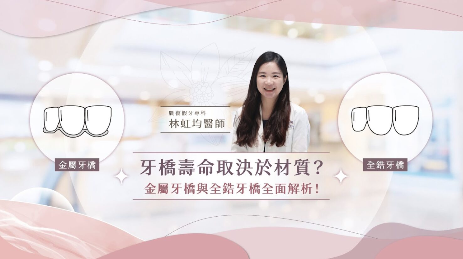 當牙齒缺損時，相信很多人都曾經猶豫該選擇牙橋還是植牙？而在決定使用牙橋後，又開始煩惱該選擇金屬牙橋還是全鋯牙橋？其實，牙橋的壽命不僅取決於材質，個人咬合習慣、口腔清潔、醫師技術都會影響使用年限。今天就帶您深入剖析牙橋材質的優缺點，幫助您做出最適合自己的選擇！