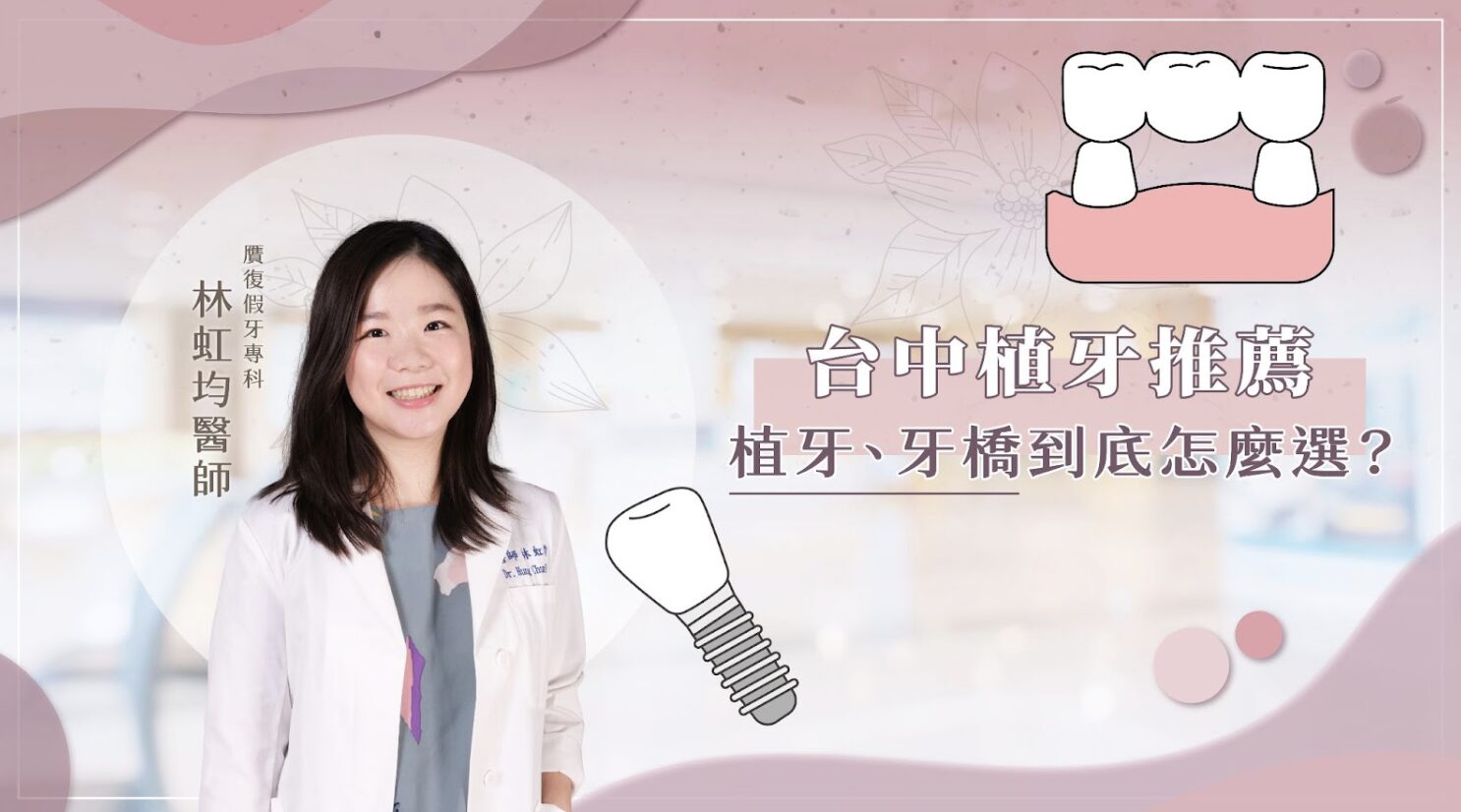 當面對少量缺牙時，許多人心中常浮現一個大問號：「我到底該選植牙，還是做牙橋比較好？」每一位患者的口腔狀況都不同，適合的修復方式也因人而異。無論是追求美觀、耐用，還是考量費用與治療時間，選對方法都能幫助大家重拾咬合功能與自信笑容。這篇文章將由贋復假牙專科醫師的角度，帶大家完整了解植牙與牙橋的差異、優劣比較，並提供選擇時的實用建議。