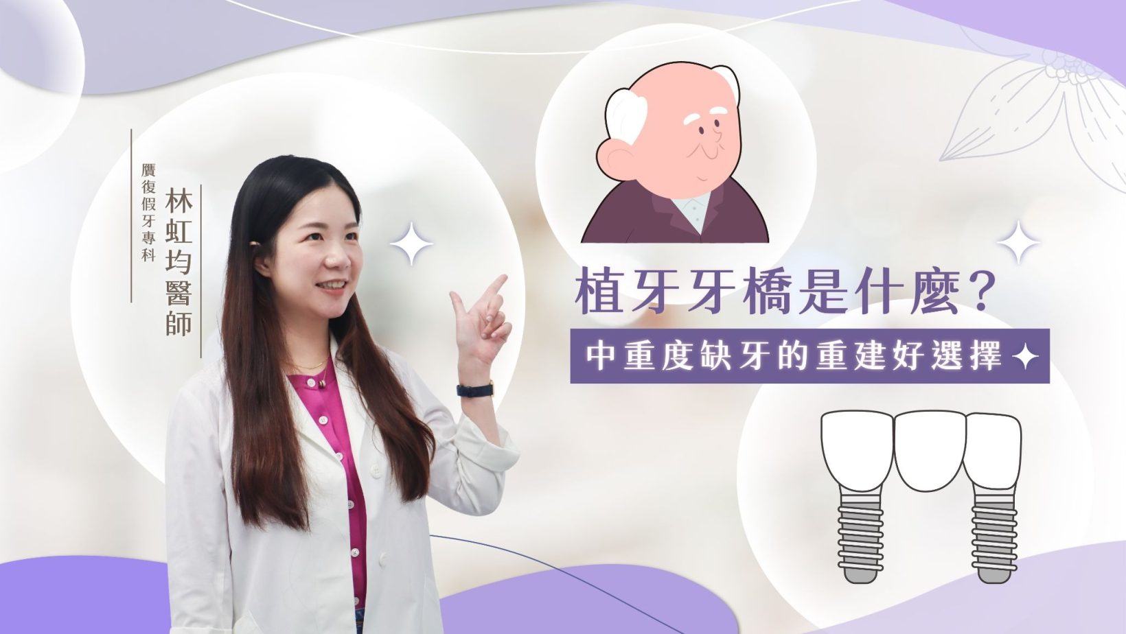 植牙牙橋是什麼？中重度缺牙的重建好選擇
