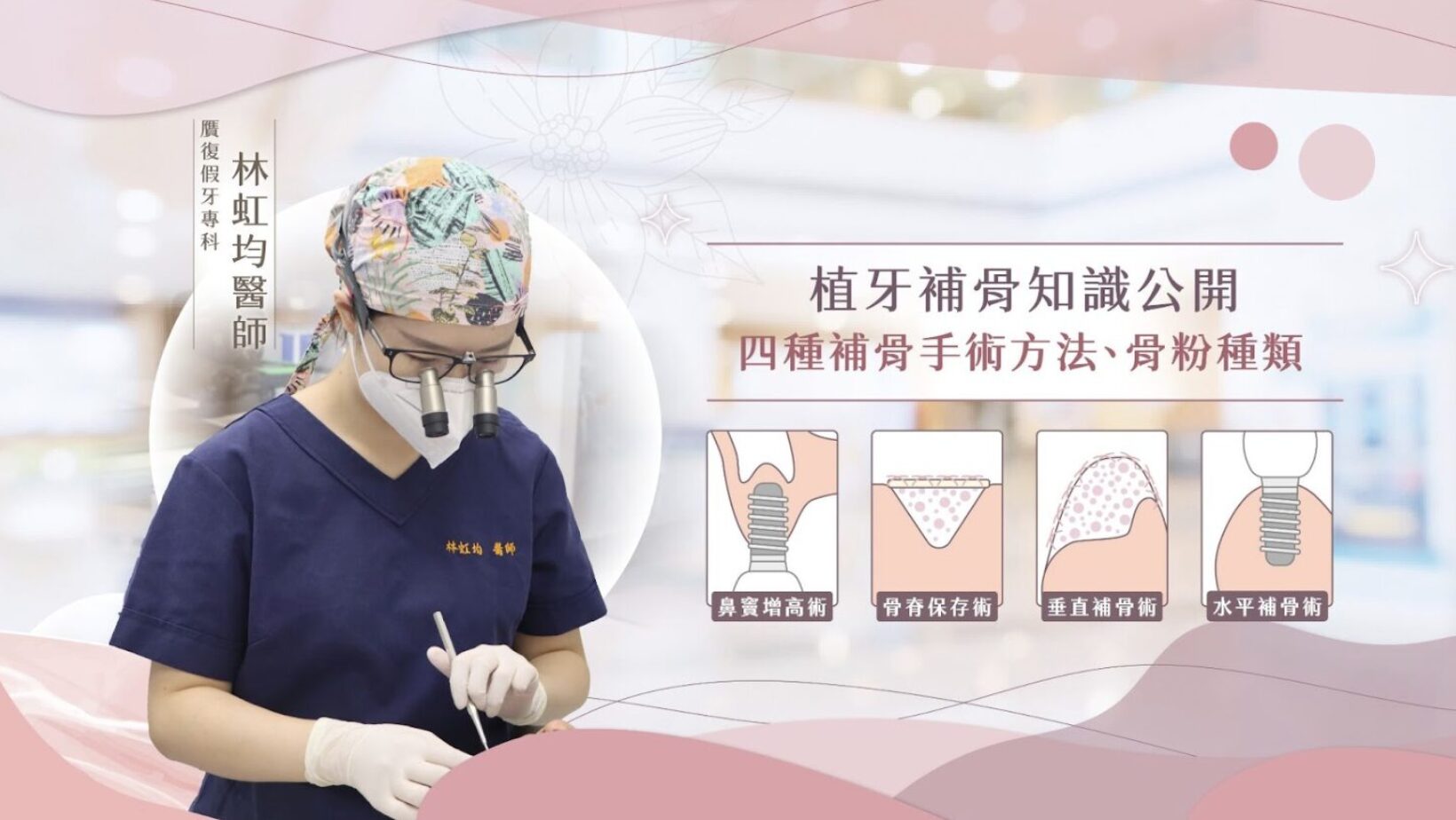 仔細想想，缺牙既影響咀嚼又影響外貌，真的好令人苦腦。 而植牙是一種能恢復功能與美觀的有效解決方案，但成功的關鍵在於齒槽骨的穩固程度。就像建造房子需要堅實的地基，齒槽骨不足時，無論植體再先進，仍可能因支撐不足而失敗。因此，在植牙之前，進行齒槽骨的評估及必要的補骨治療，是確保植牙穩定性與長期成功的關鍵。齒槽骨就像建築物的基石，提供穩固的支撐，同時為植體的骨整合奠定基礎。