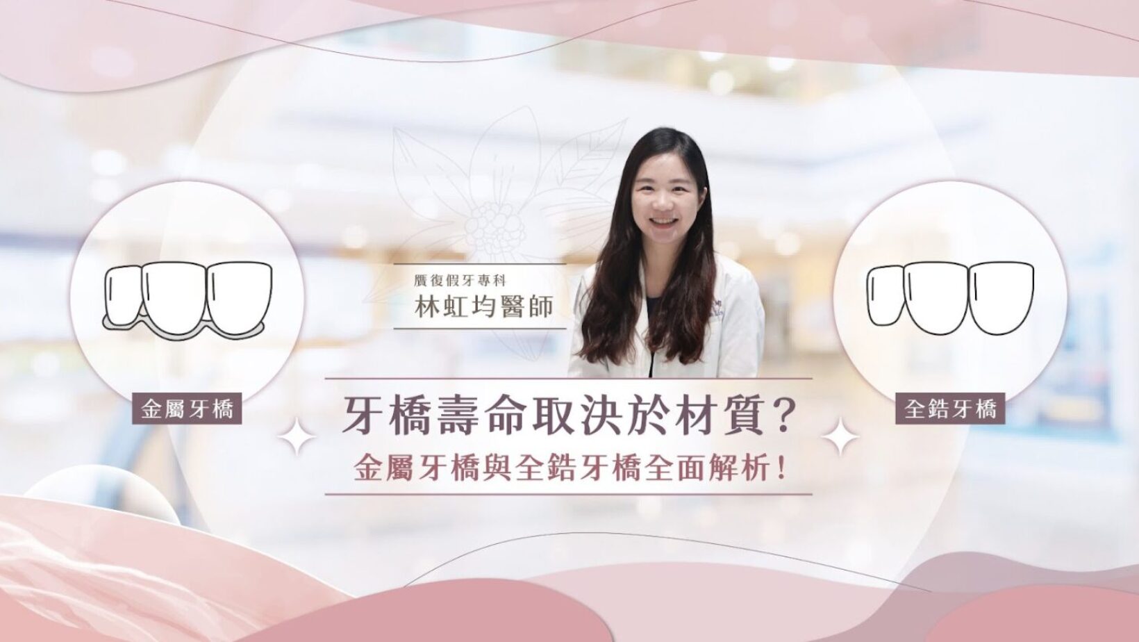 當牙齒缺損時，相信很多人都曾經猶豫該選擇牙橋還是植牙？而在決定使用牙橋後，又開始煩惱該選擇金屬牙橋還是全鋯牙橋？其實，牙橋的壽命不僅取決於材質，個人咬合習慣、口腔清潔、醫師技術都會影響使用年限。今天就帶您深入剖析牙橋材質的優缺點，幫助您做出最適合自己的選擇！