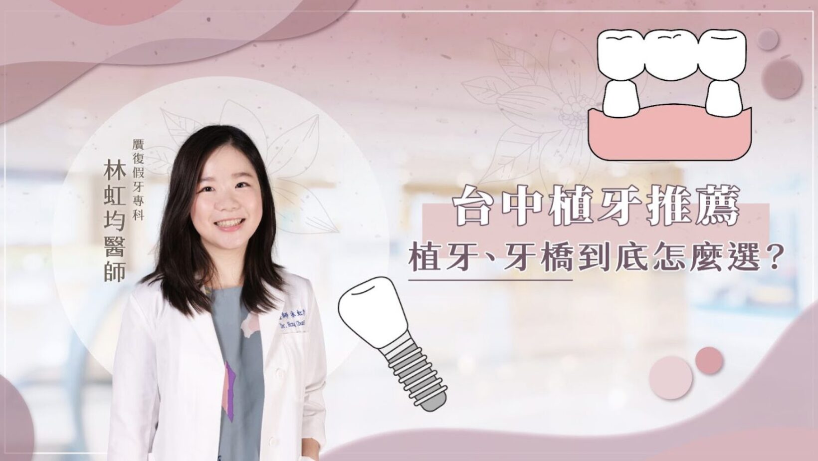 當面對少量缺牙時，許多人心中常浮現一個大問號：「我到底該選植牙，還是做牙橋比較好？」每一位患者的口腔狀況都不同，適合的修復方式也因人而異。無論是追求美觀、耐用，還是考量費用與治療時間，選對方法都能幫助大家重拾咬合功能與自信笑容。這篇文章將由贋復假牙專科醫師的角度，帶大家完整了解植牙與牙橋的差異、優劣比較，並提供選擇時的實用建議。